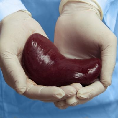 Kidney Transplantation