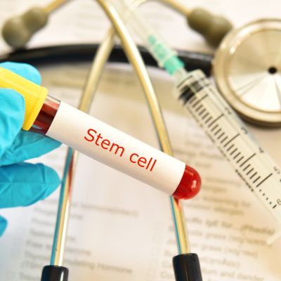 Stem Cell Treatments