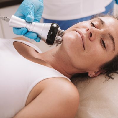 Radiofrequency Skin Tightening